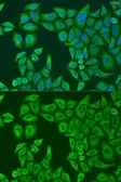 Anti-ABCF2 antibody used in Immunocytochemistry/ Immunofluorescence (ICC/IF). GTX32985