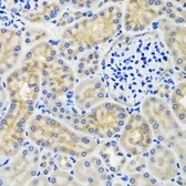 Anti-ANTXR2 antibody used in IHC (Paraffin sections) (IHC-P). GTX33011