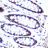 Anti-APIP antibody used in IHC (Paraffin sections) (IHC-P). GTX33013