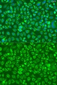 Anti-C5 / C5b antibody used in Immunocytochemistry/ Immunofluorescence (ICC/IF). GTX33052
