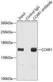 Anti-CCAR1 antibody used in Immunoprecipitation (IP). GTX33069