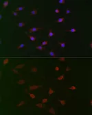 Anti-CDC34 antibody used in Immunocytochemistry/ Immunofluorescence (ICC/IF). GTX33081