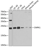 Anti-CMPK1 antibody used in Western Blot (WB). GTX33102
