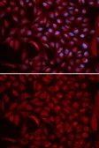 Anti-Cullin 5 antibody used in Immunocytochemistry/ Immunofluorescence (ICC/IF). GTX33130