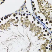 Anti-DDX41 antibody used in IHC (Paraffin sections) (IHC-P). GTX33151