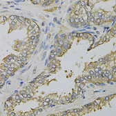 Anti-eIF4B antibody used in IHC (Paraffin sections) (IHC-P). GTX33175