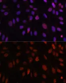Anti-HOXB1 antibody used in Immunocytochemistry/ Immunofluorescence (ICC/IF). GTX33246