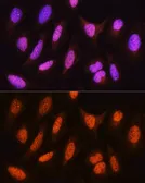 Anti-HSPA2 antibody used in Immunocytochemistry/ Immunofluorescence (ICC/IF). GTX33251