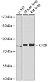 Anti-KIF2B antibody used in Western Blot (WB). GTX33286