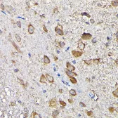 Anti-MTHFD1L antibody used in IHC (Paraffin sections) (IHC-P). GTX33331