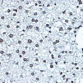 Anti-MYST2 antibody used in IHC (Paraffin sections) (IHC-P). GTX33341