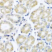 Anti-NDUFB10 antibody used in IHC (Paraffin sections) (IHC-P). GTX33350