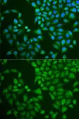 Anti-Pancreatic Lipase antibody used in Immunocytochemistry/ Immunofluorescence (ICC/IF). GTX33384