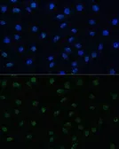 Anti-PELP1 antibody used in Immunocytochemistry/ Immunofluorescence (ICC/IF). GTX33402