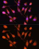 Anti-PPM1A antibody used in Immunocytochemistry/ Immunofluorescence (ICC/IF). GTX33423