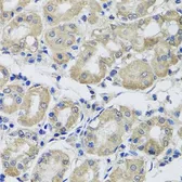 Anti-ST8SIA2 antibody used in IHC (Paraffin sections) (IHC-P). GTX33522