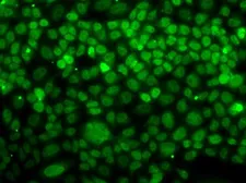 Anti-UFD1L antibody used in Immunocytochemistry/ Immunofluorescence (ICC/IF). GTX33570
