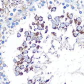 Anti-WISP2 antibody used in IHC (Paraffin sections) (IHC-P). GTX33585