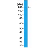 Anti-Acetyl-CoA Carboxylase 1 antibody [RM232] used in Western Blot (WB). GTX33608
