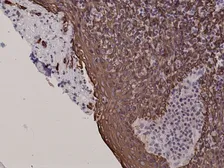 Anti-Cytokeratin 5 antibody [RM226] used in IHC (Paraffin sections) (IHC-P). GTX33612