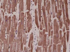 Anti-Desmin antibody [RM234] used in IHC (Paraffin sections) (IHC-P). GTX33613
