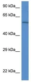 Anti-Plxdc2 antibody used in Western Blot (WB). GTX33946