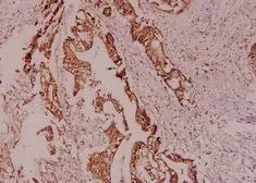 Anti-HSL antibody used in IHC (Paraffin sections) (IHC-P). GTX33956