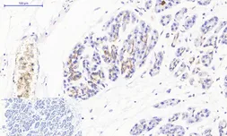 Anti-JAK3 antibody used in IHC (Paraffin sections) (IHC-P). GTX34020