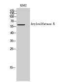 Anti-Arylsulfatase K antibody used in Western Blot (WB). GTX34042