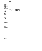 Anti-COP1 antibody used in Western Blot (WB). GTX34159