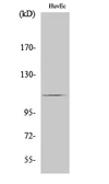 Anti-RIN3 antibody used in Western Blot (WB). GTX34163