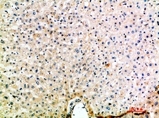 Anti-MIP5 antibody used in IHC (Paraffin sections) (IHC-P). GTX34183