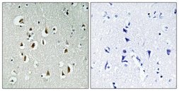 Anti-CCNB1IP1 antibody used in IHC (Paraffin sections) (IHC-P). GTX34190