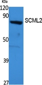 Anti-SCML2 antibody used in Western Blot (WB). GTX34191