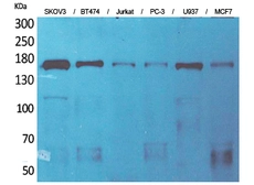 Anti-SCP2 antibody used in Western Blot (WB). GTX34245