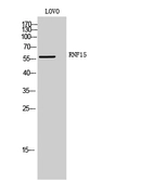 Anti-TRIM38 antibody used in Western Blot (WB). GTX34281