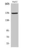 Anti-COL4A6 antibody used in Western Blot (WB). GTX34324