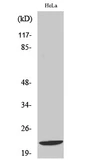 Anti-DIRAS1 antibody used in Western Blot (WB). GTX34354