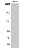 Anti-Factor VIII antibody used in Western Blot (WB). GTX34370