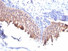 Anti-Cytokeratin 10 antibody [SPM261] used in IHC (Paraffin sections) (IHC-P). GTX34624