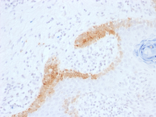 Anti-Cytokeratin 15 antibody [KRT15/1699] used in IHC (Paraffin sections) (IHC-P). GTX34634