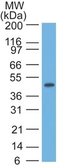 Anti-Cytokeratin 17 antibody [SPM560] used in Western Blot (WB). GTX34635