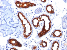 Anti-Cytokeratin 18 antibody [KRT18/834] used in IHC (Paraffin sections) (IHC-P). GTX34642