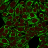 Anti-Cytokeratin 8 antibody [SPM192] used in Immunocytochemistry/ Immunofluorescence (ICC/IF). GTX34668