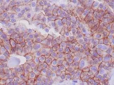 Anti-E-Cadherin antibody [CDH1/1525] used in IHC (Paraffin sections) (IHC-P). GTX34680