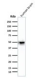 Anti-GFAP antibody [SPM507] used in Western Blot (WB). GTX34757