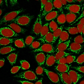 Anti-HSP60 antibody [GROEL/730] used in Immunocytochemistry/ Immunofluorescence (ICC/IF). GTX34787