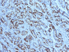 Anti-Mucin 6 antibody [CLH5] used in IHC (Paraffin sections) (IHC-P). GTX34874