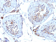 Anti-SHBG antibody [SHBG/245] used in IHC (Paraffin sections) (IHC-P). GTX35081