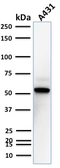 Anti-TOX3 antibody [TOX3/1123] used in Western Blot (WB). GTX35139